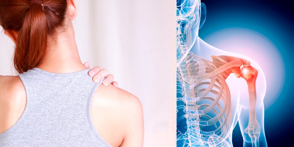 A váll osteoarthritisének kialakulása fokozatosan állandó fájdalomhoz vezet