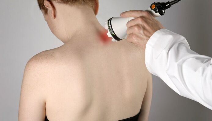 lézerterápia a nyaki osteochondrosisban