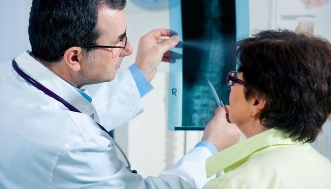 radiográfia mint módszer a nyaki osteochondrosis diagnosztizálására